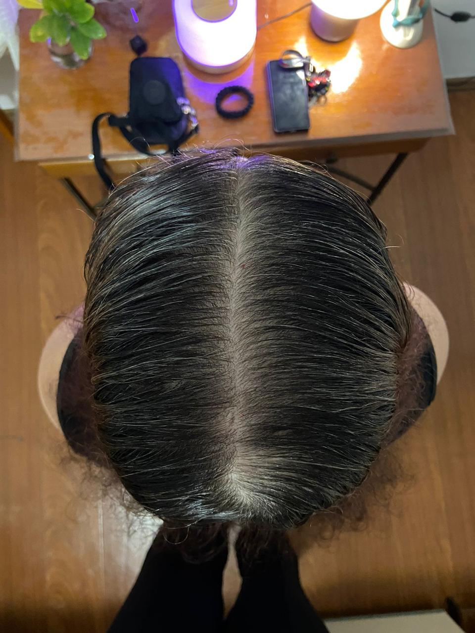 Resultado depois do tratamento